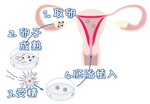 国内试管供卵代孕